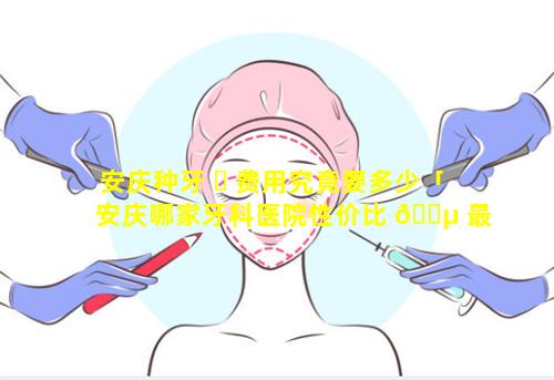 安庆种牙 ☘ 费用究竟要多少「安庆哪家牙科医院性价比 🌵 最高」